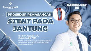 Prosedur Pemasangan Stent pada Jantung - Dr. dr. M. Fadil, Sp. J.P, Subsp. K.I. (K), FIHA