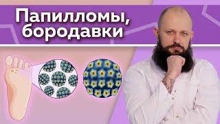 Можно ли уксусом удалить бородавку? / Как избавиться от бородавок? / Точка долголетия для здоровья!