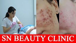 SN BEAUTY CLINIC | Москва | Сезим Нурбаевна