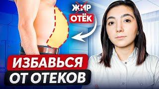 КАК УБРАТЬ ОТЕКИ И ПОХУДЕТЬ? Причины отеков и лечение.