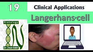 19-Langerhans cellفرط الحساسية الجلدى و غيره-Clinical applications of Histology-Skin