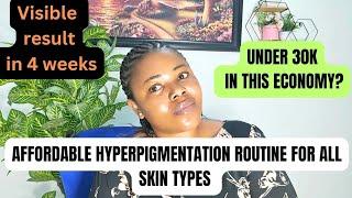 The Best Hyperpigmentation Skincare Routine (for EVERY Skin Tone)