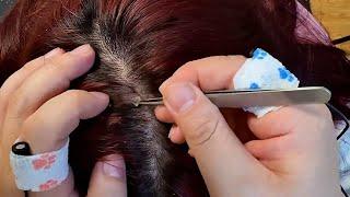 ASMR  Immersive Scalp Examination | Dandruff Cleaning | No Talking