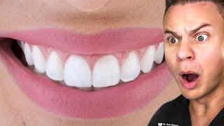 Dentist Reveals Secret To The PERFECT Smile!