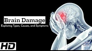 Brain Damage Decoded: Breaking Down Types, Causes, and Symptoms