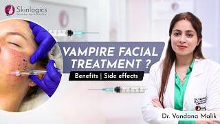 Vampire Facial Treatment (PRP) | Benefits & Side Effects | Best Dermatologist in Noida | Skinlogics