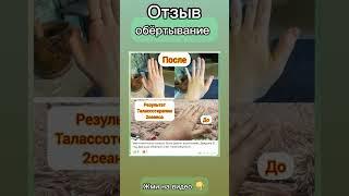 Всего 3 сеанса и вот результат  подробности в коментарии #высыпания  #экзема