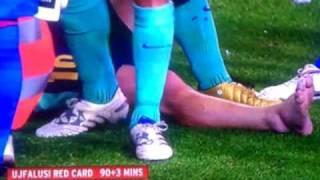 Lionel Messi injury Atletico Madrid Vs Barcelona 1-2 - Tomas Ujfalusi Red Card  - September 19 2010