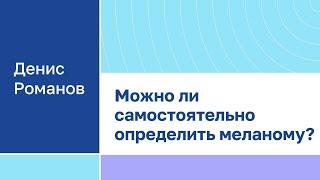 Денис Романов "Можно ли самостоятельно определить меланому?"