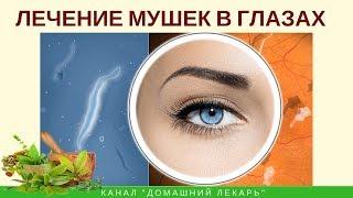 Лечение плавающих мушек в глазах: советы натуропата - Домашний лекарь - выпуск №232