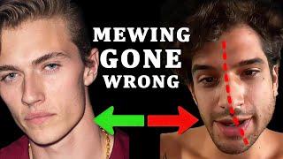 20 MEWING MISTAKES That Are Setting You Back