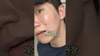 좁쌀 여드름처럼 보이는데 짜면 ‘절대’ 안되는 4가지