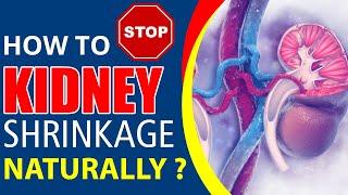 Karma Ayurveda shows ways to Stop Kidney Shrinkage Naturally | Karma Ayurveda Hospital