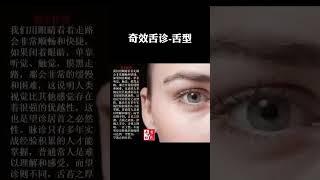 中医讲究望闻问切四诊，但是其望字是居首，别有深意。因为按东方人的习惯，凡是最高的最重要的往往都放在首位。以示他的一个首要的地位。 近年来，李芳祥老师的奇效舌诊技术凭借其在疾病诊疗方面的卓越能力，在临