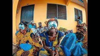 713 Cataract Surgeries in 5 Days in Ghana Africa