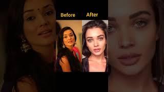 Amy Jackson plastic surgery looks #viral #youtubeshorts#shorts  #bollywood #actress#amyjackson