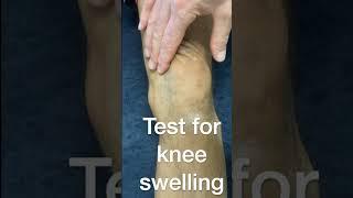 Test for knee swelling