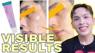 GOOD MOLECULES RETINOL REVIEW | 0.1% WITH BAKUCHIOL! WORTH IT BA? SIR LAWRENCE