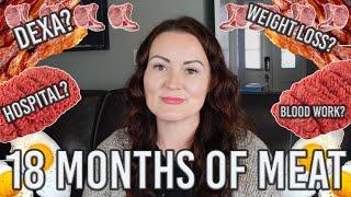 18 Month Carnivore Update: Weight Loss Stall, CGM Data, Hospital Stay?!