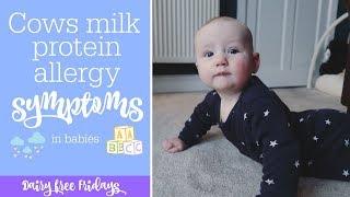 Cows Milk Protein Allergy (CMPA) symptoms in a baby | Dairy Free Fridays