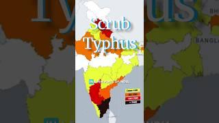 Scrub Typhus #surat #epidemiology