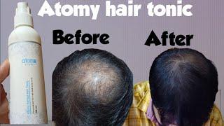 Atomy Saengmodan Hair Tonic // Global Atomy //  #hairtonic #globalatomy #atomy #hair #atomykorea