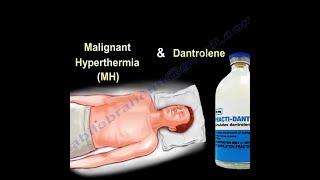 Malignant Hyperthermia