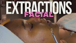 FACIAL W/EXTRACTIONS *close up* #skincare #extraction #pimplepopping