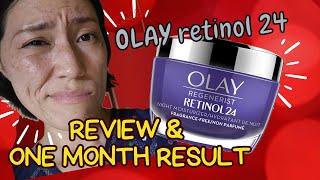 OLAY RETINOL 24  Review & One month result 【BEFORE & AFTER】