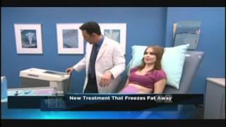 Liposuction Alternative - Celebrities - The Doctors