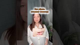 Психосоматика стоматита #германскаяноваямедицина #гнм