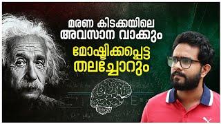 അവസാനമായി പറഞ്ഞ വാക്കുകളും മോഷ്ടിക്കപ്പെട്ട തലച്ചോറും ! Untold Story of Albert Einstein In Malayalam