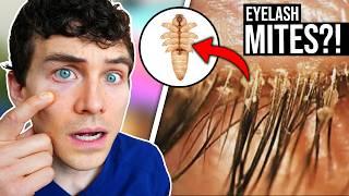 Do Microscopic Mites Live in Your Eyelashes RIGHT NOW?!