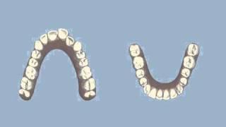 How do Invisalign Works - Cosmetic Dental Associates San Antonio,TX Dental Practice