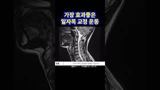 가장 효과좋은 일자목 교정 운동
