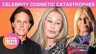 Behind the 'GLAM': Celebrity COSMETIC SURGERIES Gone WRONG | HypeLine