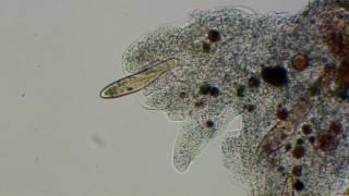 Amoeba stalks and captures paramecia to original music