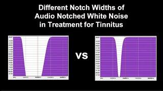 Notched Audio White Noise Sampler of Different Notch Widths in the Treatment for Tinnitus