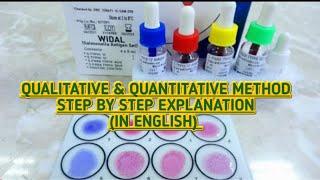 Widal test for typhoid fever.Qualitative & Quantitative method.Procedure & result interpretation.