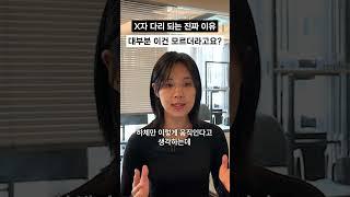 나도 모르게 x자 다리 되는 이유