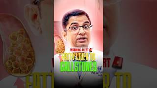 Fatty Liver Can Cause Gallstones! Reverse It with These 2 Tips!
