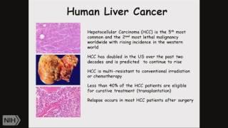 Demystifying Medicine 2016: Hepatocellular Cancer