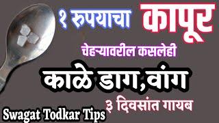 १ रुपयाचा कापूर काळे डाग वांग ३ दिवसांत गायब होणार घरगुती उपाय,स्वागत तोडकर वांगवर घरगुती उपाय, Vang