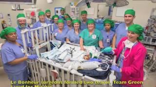 Le Bonheur Children's Hospital in Memphis, Tenn., separates conjoined twins