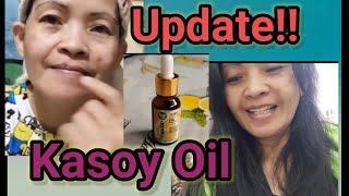 UPDATE!! HOW TO REMOVE MY MOLES USING KASOY OIL?( Cashew Oil ) PART 2 / Rebecca Amador Vlogs