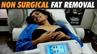 Non surgical fat removal #dezireclinicindia