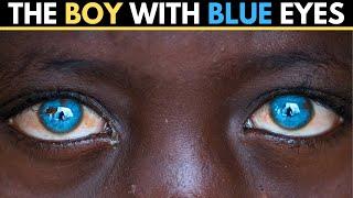 The AFRICAN Boy With The BLUE Eyes