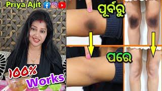 Naturally Clean Dark Elbow,Knee,Underarms at Home | in Just 5 Minutes / Priya Ajit Vlogs