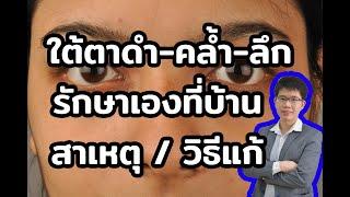 ใต้ตาดำ-คล้ำ-ลึก รักษาง่ายๆ ด้วยตัวเอง l 10นาทีกับหมอต่อ