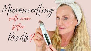 Better Results from Microneedling?  | New Bio Pen Q2: first impression & full demo